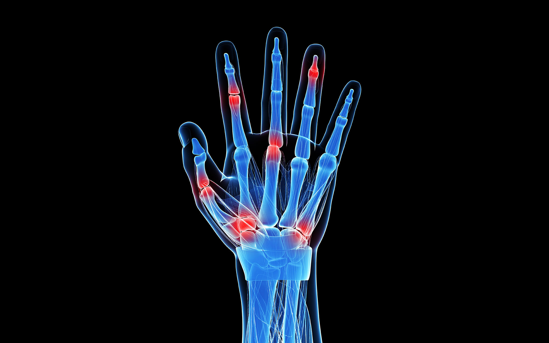 Funcionan los suplementos de colágeno contra la artritis? - Noticias Grupo  Recoletas